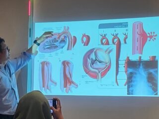 Kecepatan Menjadi Kunci Penyelamatan Nyawa pada Penanganan Penyakit Aorta Kompleks di Era Modern